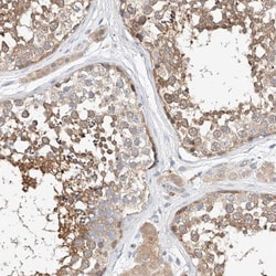 C6orf118 Antibody, Novus Biologicals 25 &mu;L; Unlabeled:Antibodies, Polyclonal